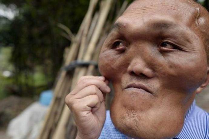 В Китае найден мужчина с головой пришельца