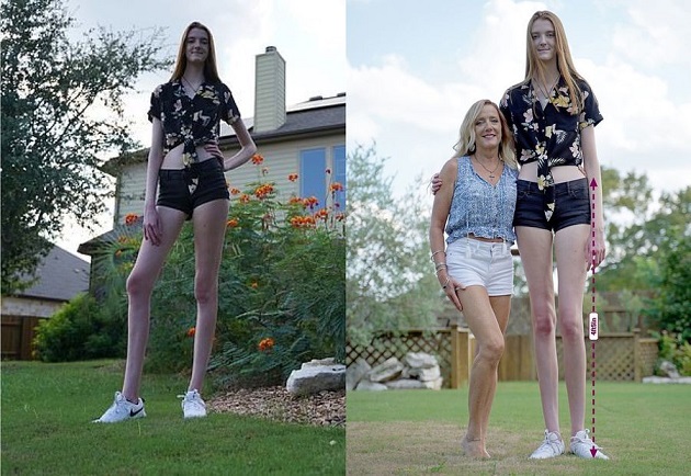 Девушка c самыми длинными ногами на планете попала в книгу рекордов Гиннесса