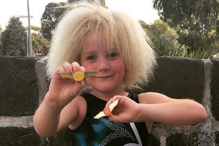 10-летняя австралийка с аномальной структурой волос прославилась в сети
